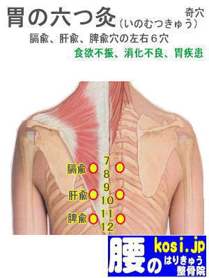 胃の六つ灸、ぎっくり腰【腰痛専門】腰のはりきゅう整骨院、福岡太宰府